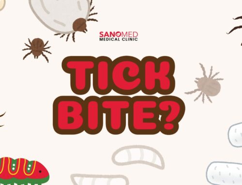 How Can You Tell If a Tick Bite Is Serious?