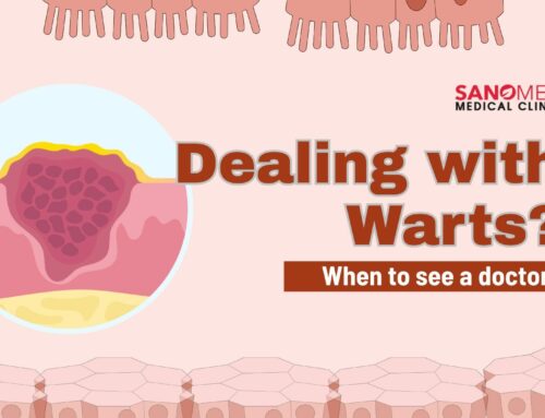 When Should You See a Doctor About a Wart?
